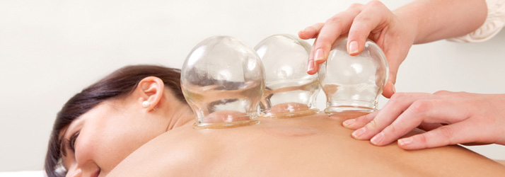 How Can Functional Cupping Help Me in Southeast FL?