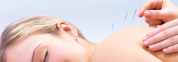 Cosmetic Acupuncture in Kingston WA