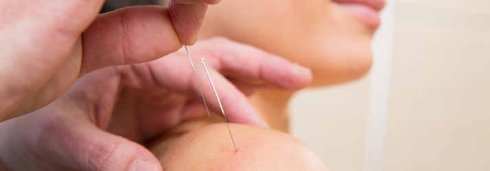 Acupuncture in Gig Harbor WA
