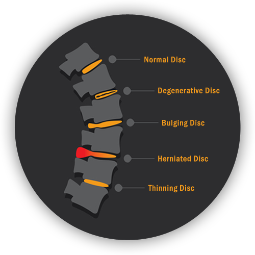 back pain graphic