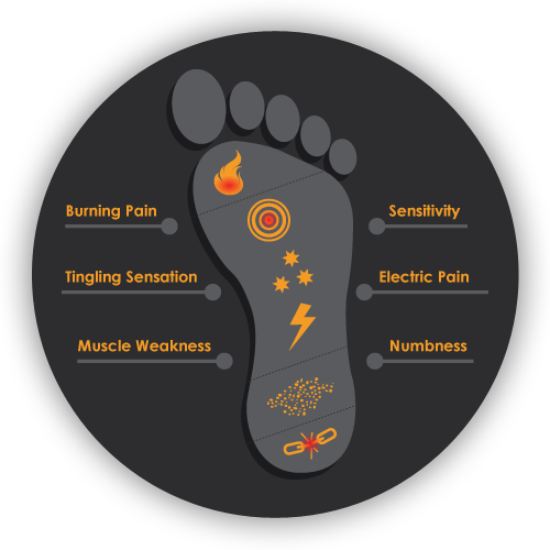 neuropathy in feet