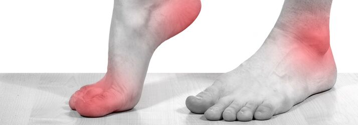 neuromas.jpg integrative neuropathy pain relief treatment