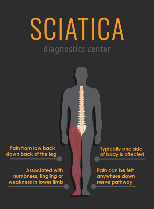 Diagnostics-Center-for-Sciatica-Pain.png Diagnostics-Center-for-Sciatica-Pain.png