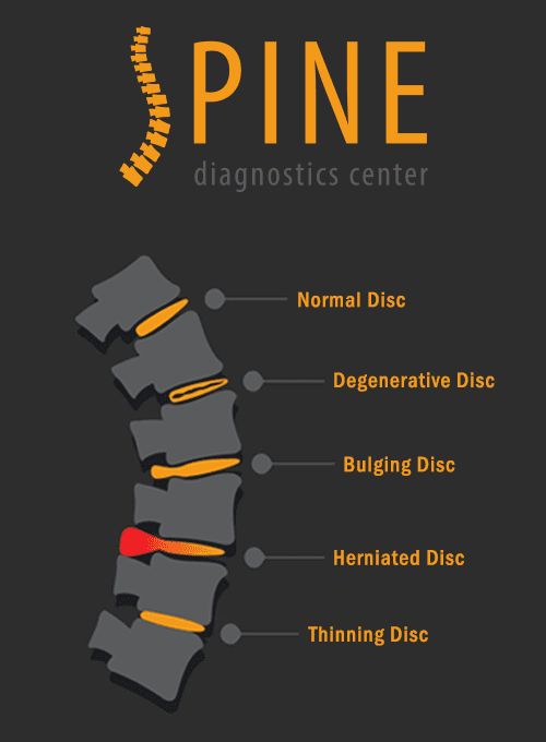 Spine-Diagnostics-Center.png