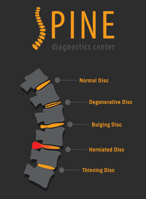Spine-Diagnostics-Center.png Spine-Diagnostics-Center.png