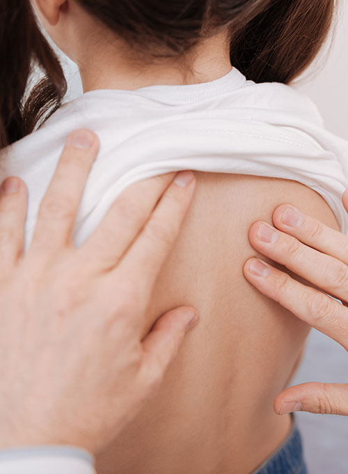 Chiropractic-Care-for-Scoliosis.jpg Chiropractic-Care-for-Scoliosis.jpg