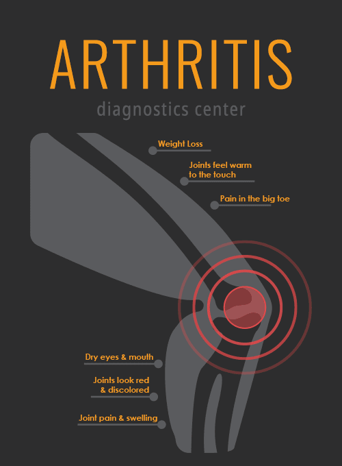Rheumatoid-Arthritis-Symptoms.png Rheumatoid-Arthritis-Symptoms.png