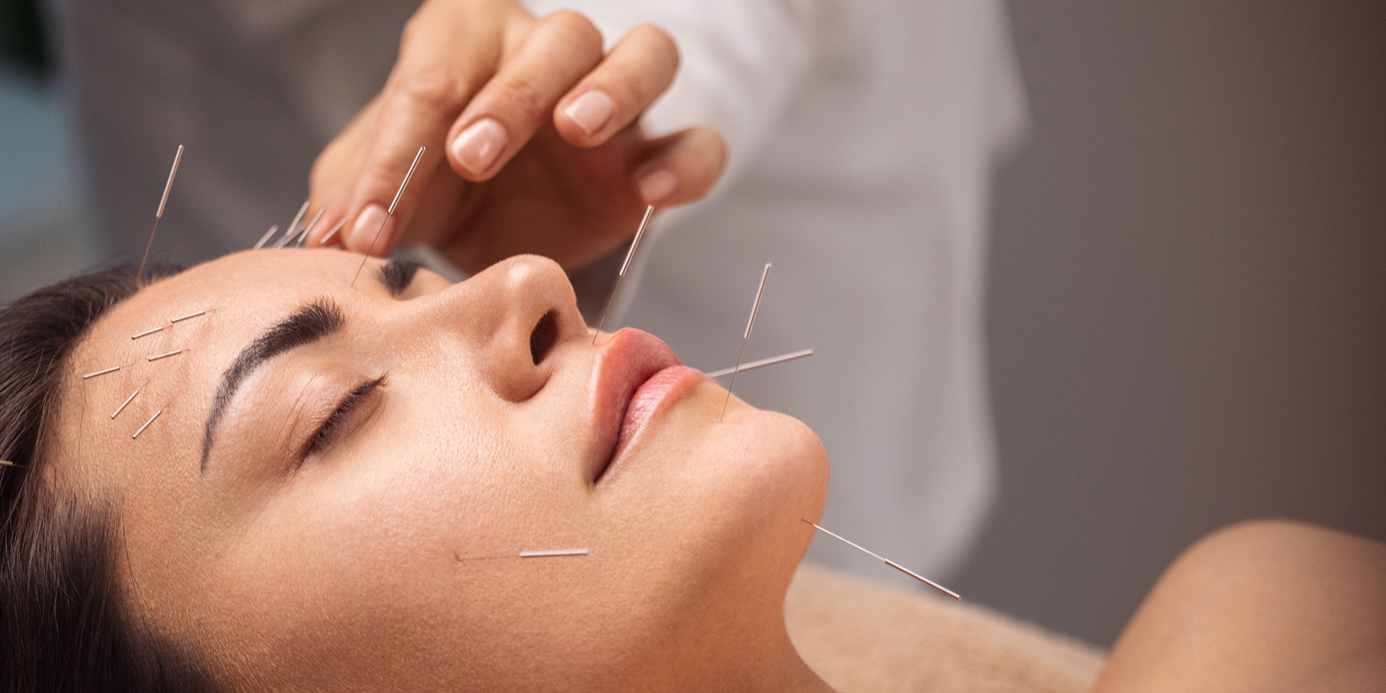 acupuncture.jpg acupuncture.jpg