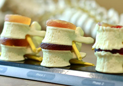 Spine-Diagram-Hero-Nollie-2.0-IP.jpg Spine-Diagram-Hero-Nollie-2.0-IP.jpg