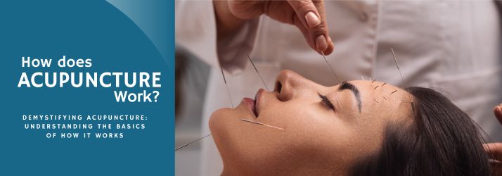 How Does Acupuncture Work in Downey CA?