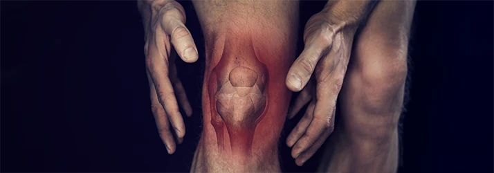 Person experiencing knee inflammation, symbolizing natural functional medicine treatments